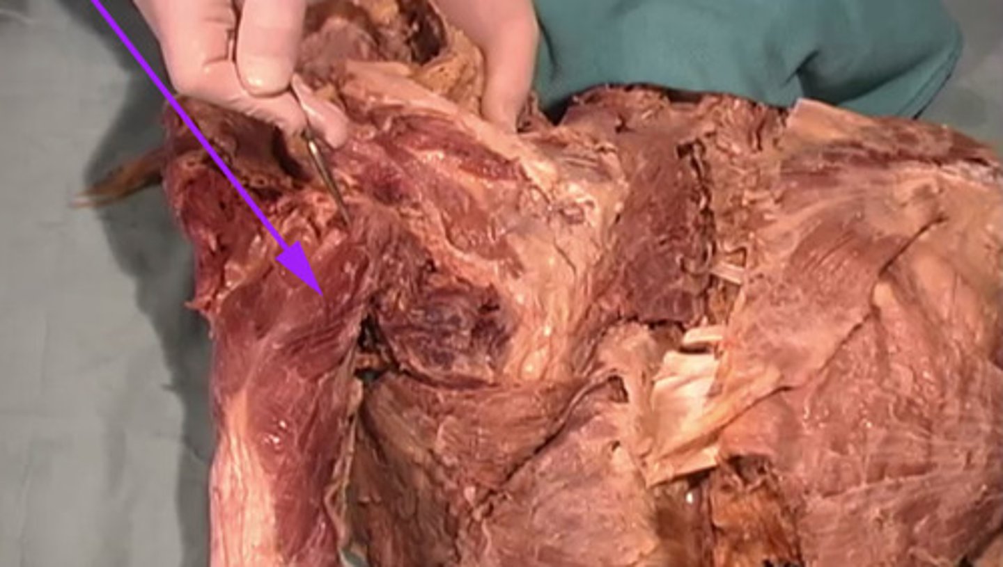 <p>The arrow is pointing to a portion of which muscle?</p>