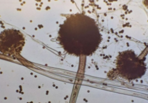 <p>Vesicles have two rows of philiades</p><p>Black conidia</p>