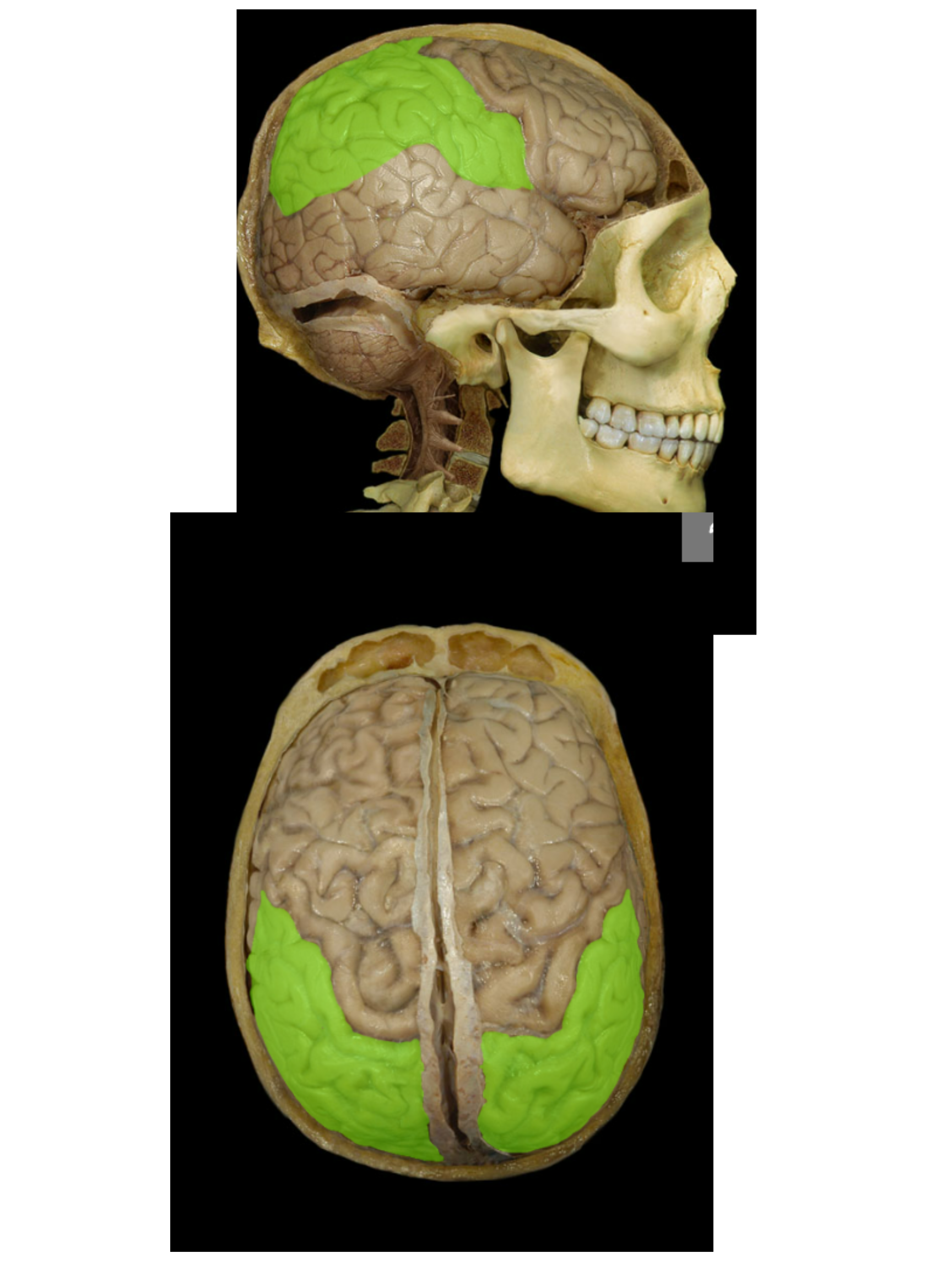 <p><span>Parietal lobe</span></p>