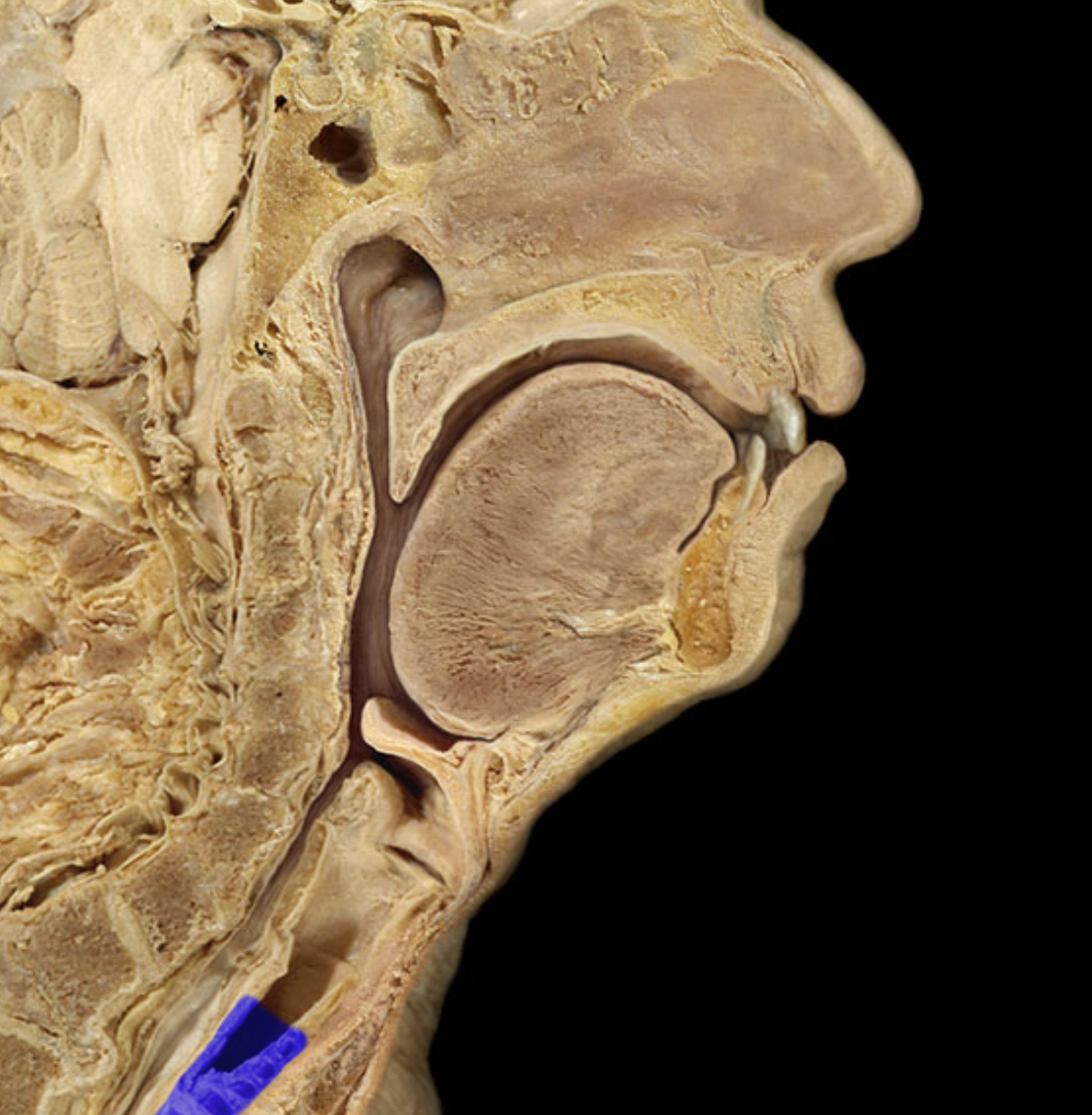 <p>Trachea - wind pipe</p>