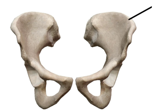 <p>identify the specific structure &amp; bone</p>