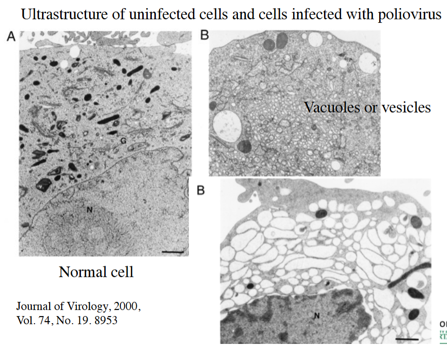 <p>Vesicles (due to replication of RNA in the vesicles/vacuoles)</p>