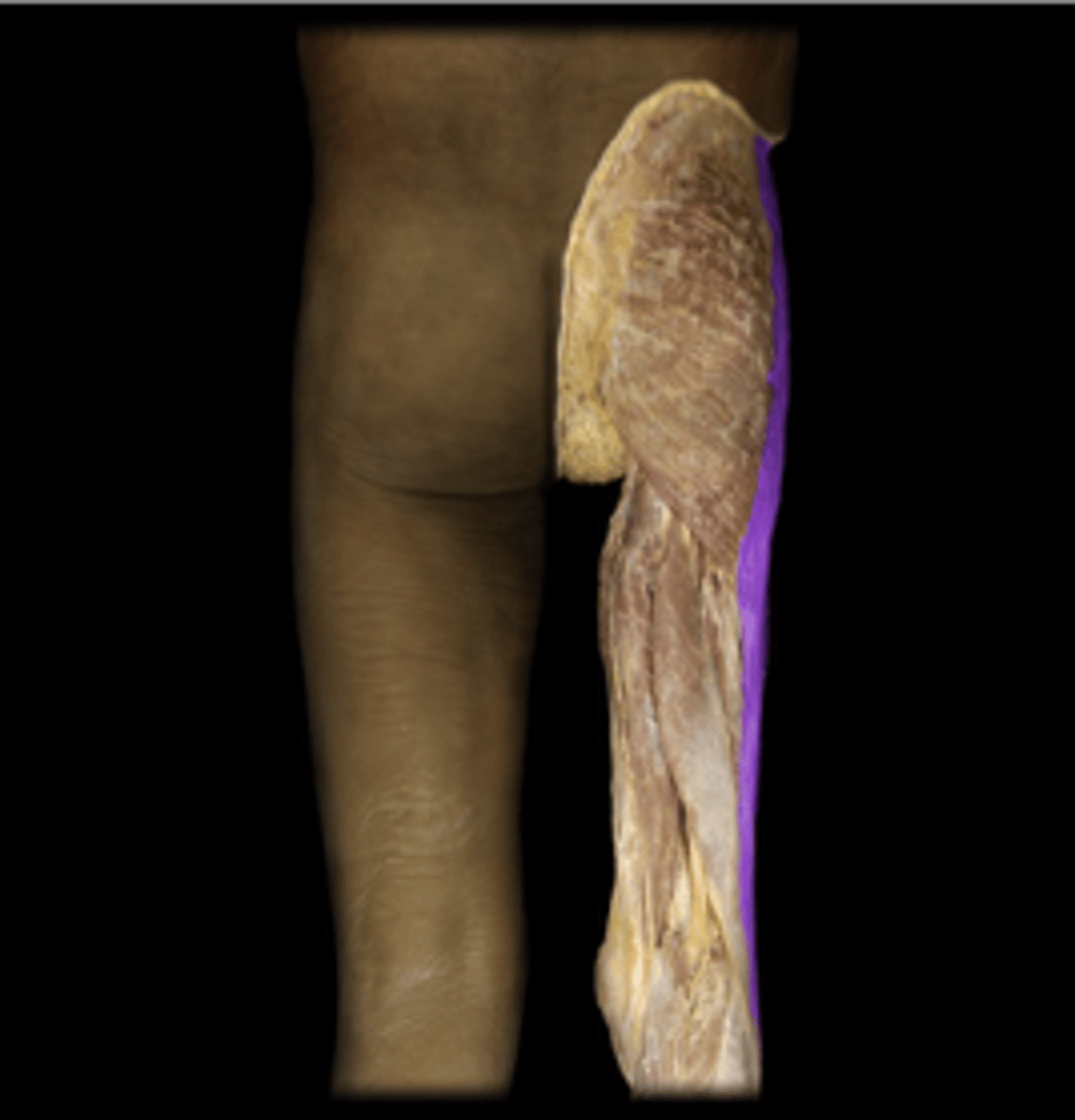 <p>What structure is indicated in purple?%</p>