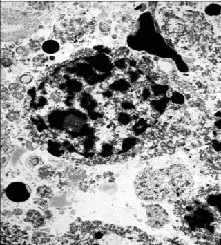 <ul><li><p>branduolio chromatinas fragmentuojasi</p></li></ul><p>(dažosi juoda spalva)</p>