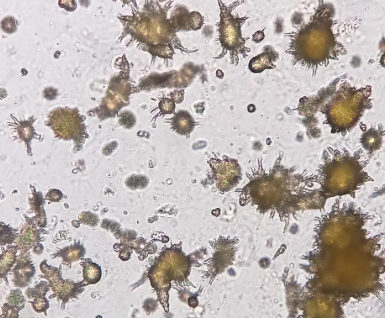 <p>Ammonium Biurate Crystals</p>