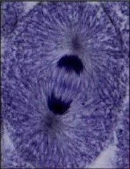 <p>What phase of mitosis is shown in this cell?</p>