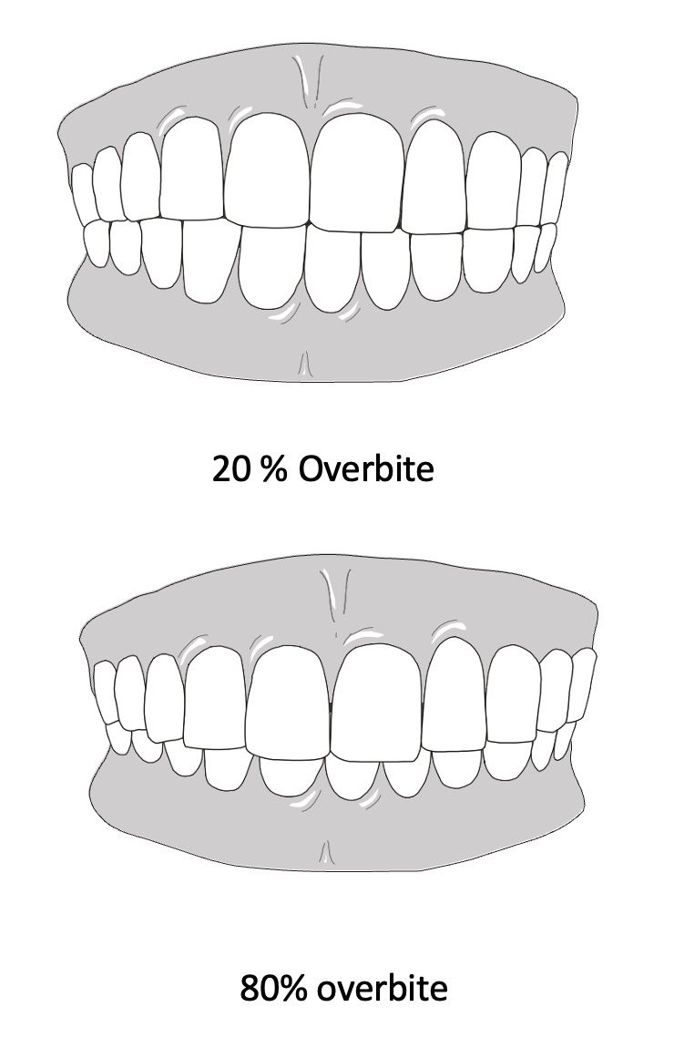 <p>10-20%</p>