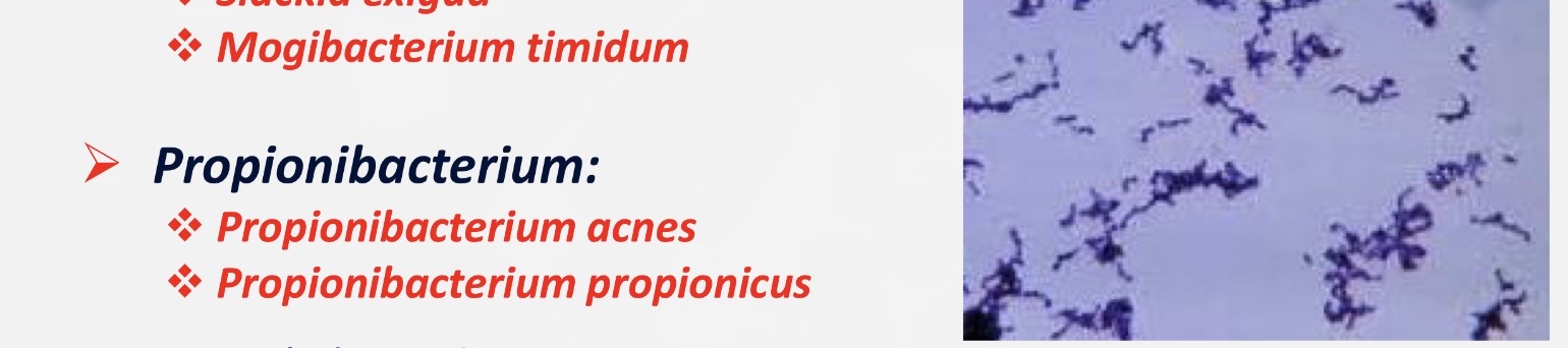 <p>gram positive, rods, anaerobic.</p>