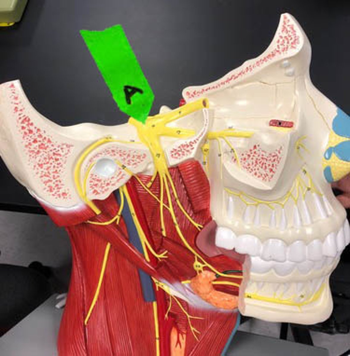 <p>Identify the name and number of this cranial nerve.</p>