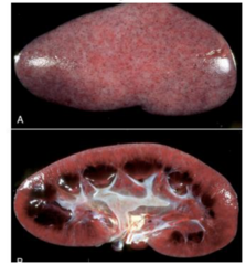 <p>Which disease will have these renal lesions grossly in pig kidneys?</p>