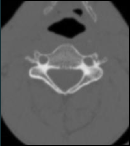 <p><span>颈椎</span></p>