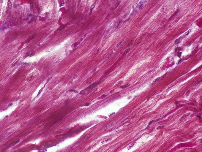 <p>Identify the type of muscle tissue shown? </p>