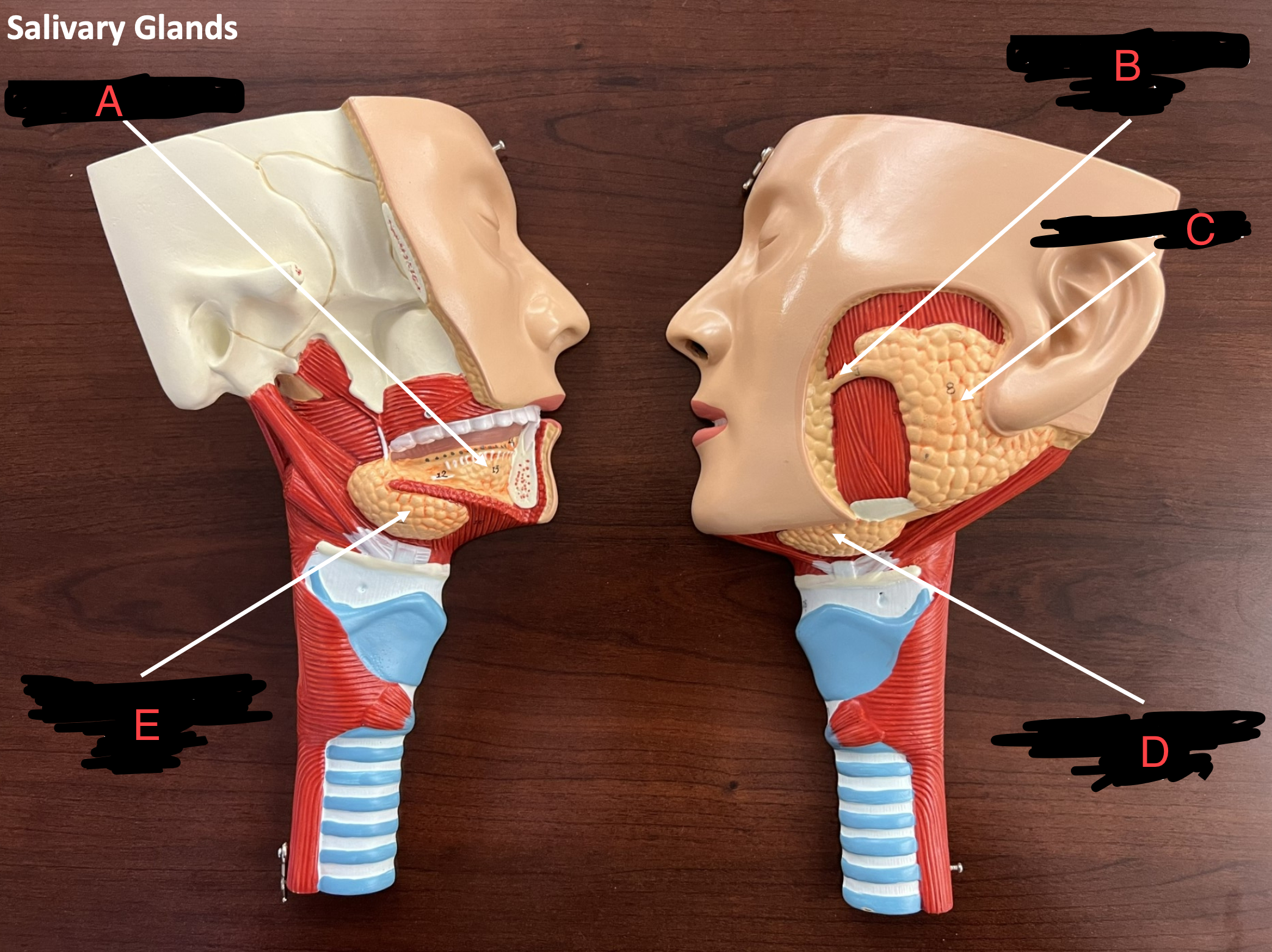 <p>what are the labeled structures of the salivary glands</p>