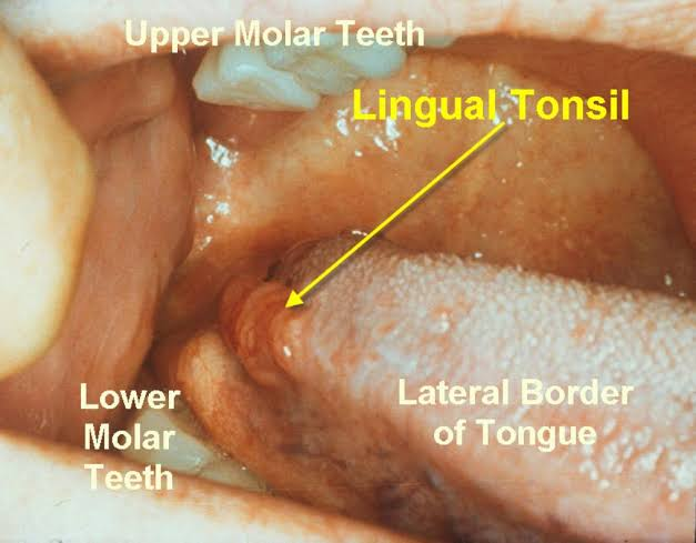 <ul><li><p>Posterior lateral border of tongue </p></li><li><p>Embedded in foliate papillae </p></li></ul><p></p>