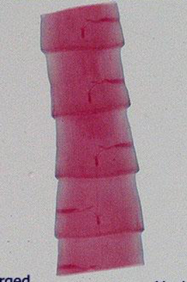 <p><span>individual, self-contained reproductive segments that make up the body (strobila) of an adult tapeworm</span></p>