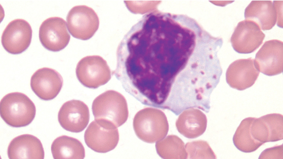 <p>what type of cell is this that contains Azorophilic granules?</p>