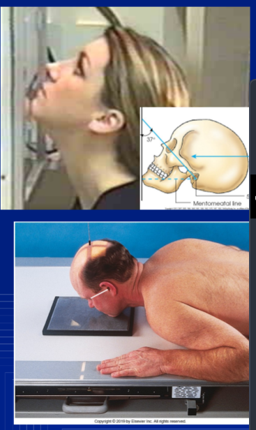 <p>sid of WATERS FACIAL BONES</p>