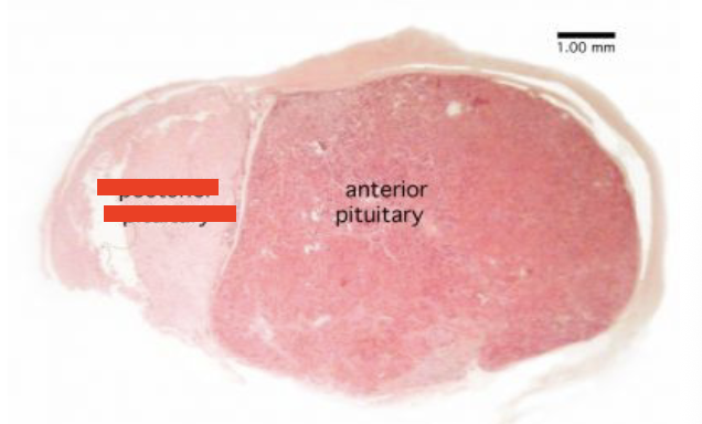 <p>What part of the Hypophysis is this? </p><p>What is the hormones released? </p><p>Function of each hormone? </p>