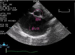 <p>Normal or abnormal?</p>