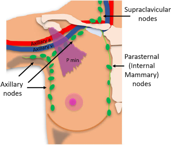 <p><span>Along the internal thoracic arteries</span></p><p><span>Key route for breast cancer metastasis. </span></p><p></p>