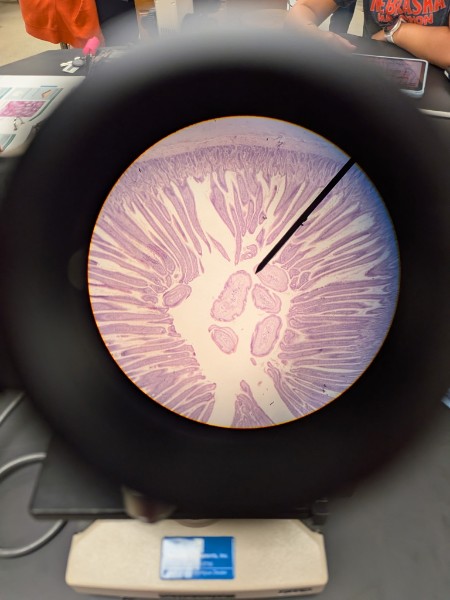 <p>Located in digestive tract lining, uterine tubes, small bronchi, gallbladder. Functions in absorption, secretion of mucus and enzymes, The ciliated type propels mucus</p>