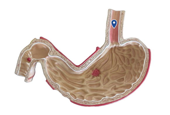 <p>Name this organ.</p>