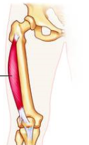 <p>A: extension at knee</p>