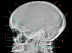 <p>What is labeled 16?</p>