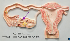 <p>Identify this structure (be specific).</p>
