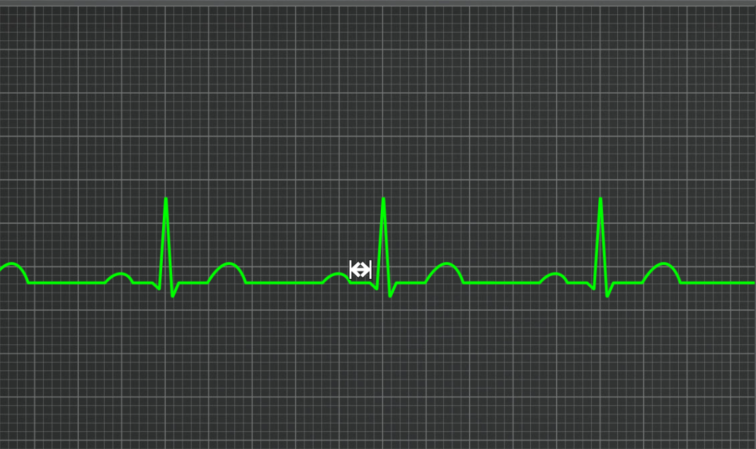 <p>What segment is this</p>