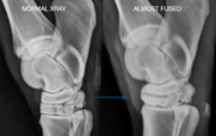 <p>Which joint is "almost fused" here?</p>