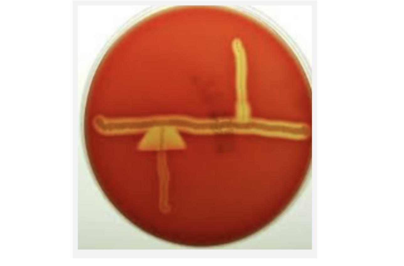 <p>A. What test is this called? </p><p>B. What media is used for this test? </p><p>C. What two bacteria result in the arrow-like appearance? </p><p>D. What type of hemolysis occurred? </p>
