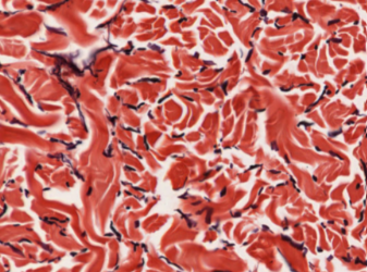 <p>what type of tissue is this? </p>