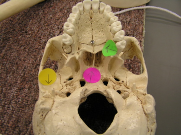 <p>Identify the bone labeled with the arrow on the green bone. </p>