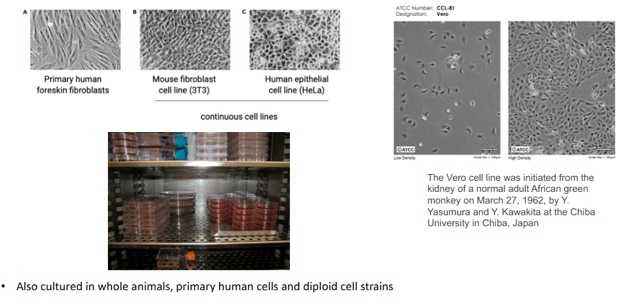 <p>Viruses are cultured in animal and human cells</p>