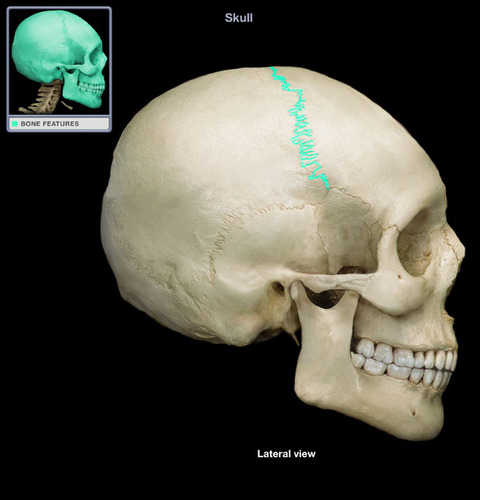 <p>fissure</p>