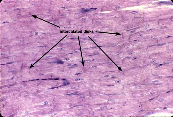 <p>Dark lines where cardiac cells join, have gap junctions for coordinated contractions, fascia adherens and desmosomes</p>