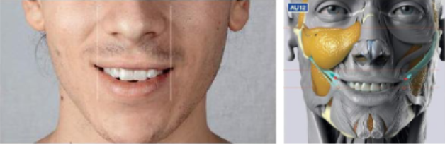 <ul><li><p>smile muscle</p></li><li><p>dimples cheeks</p></li></ul><p></p>