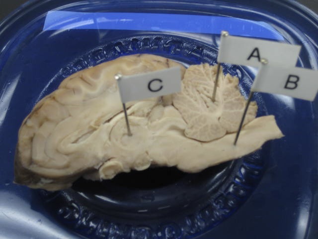 <p>Identify A, B and C? </p><p>Lab Image 10-10</p>