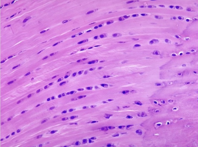 <p>NTK: what type of cartilage is this </p>