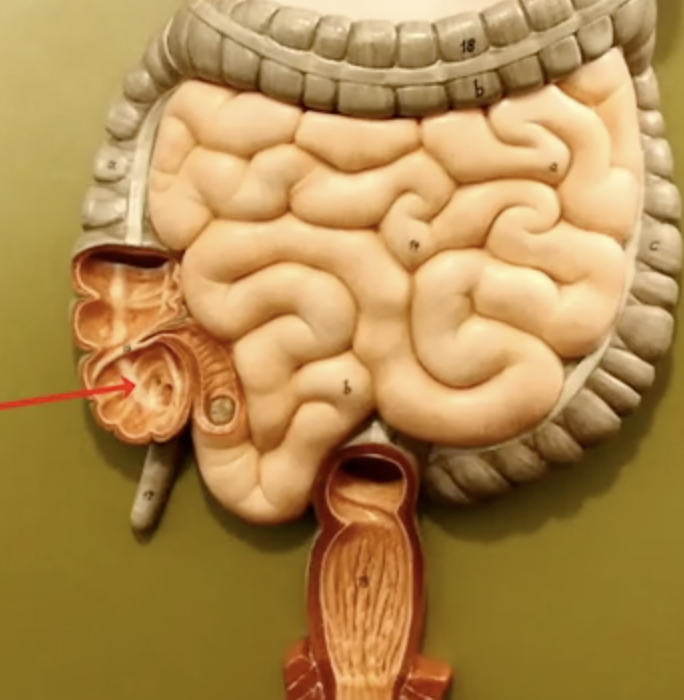 <p>What is the arrow pointing to?</p>