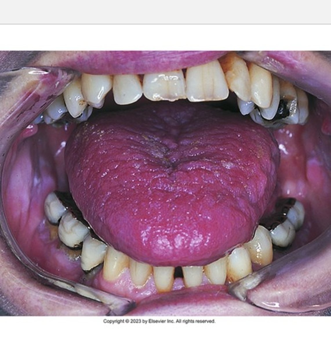 knowt flashcard image