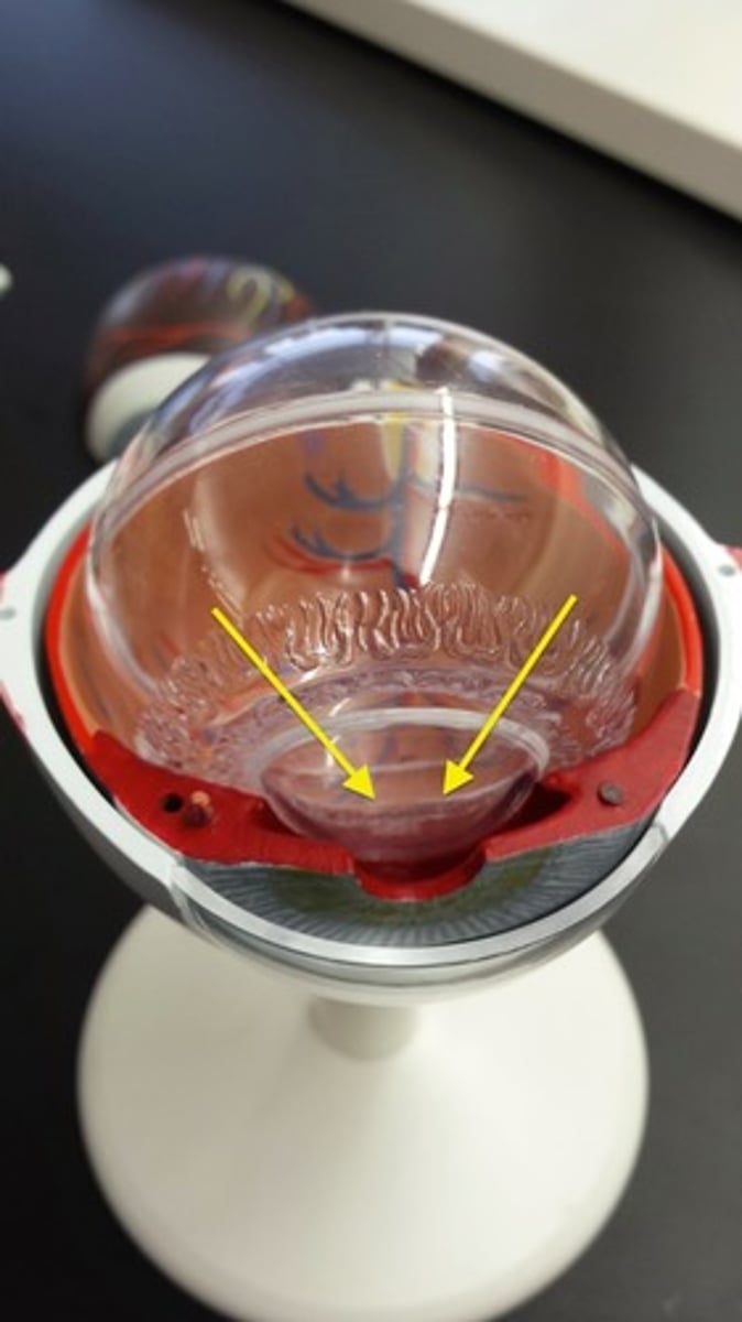 <p>What part of the eye is this?</p>