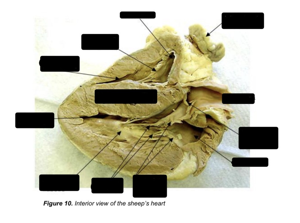<p>Label the heart</p>