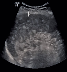 <p>Identify this image.</p>