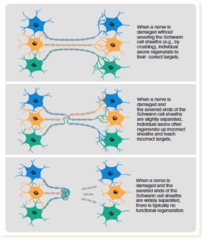 <p>The regrowth or restoration of damaged neural connections.</p>