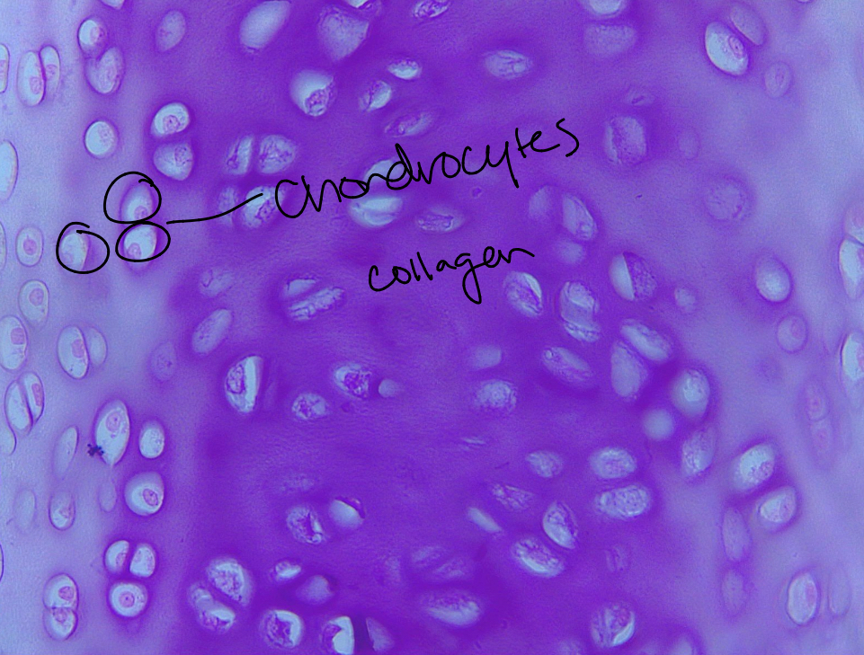 <p>Hyaline cartilage. Collagen fibers form a smooth network, chondroblasts produce the cartilage and mature into chondrocytes. Supports and reinforces; serves as a resilient cushion and resists compression. Found in the front ribs, trachea, nasal septum, and caps of joints. </p>