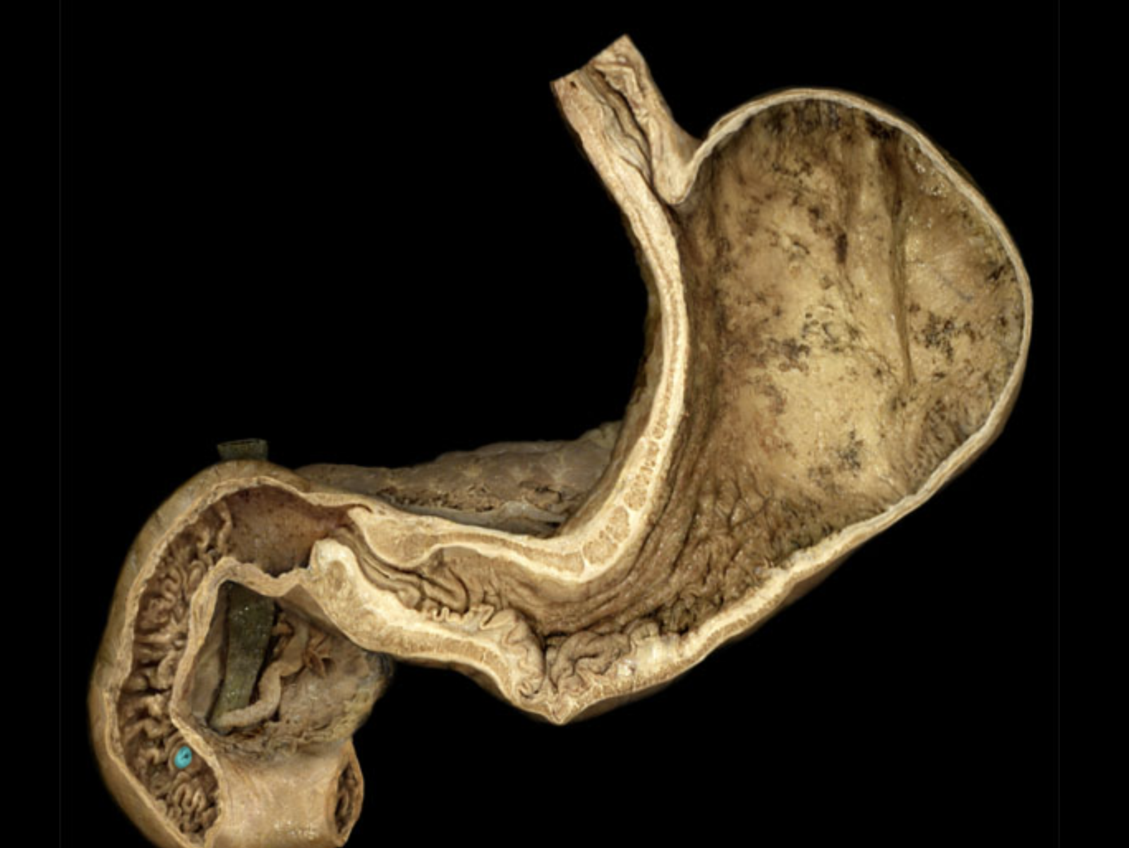 term image