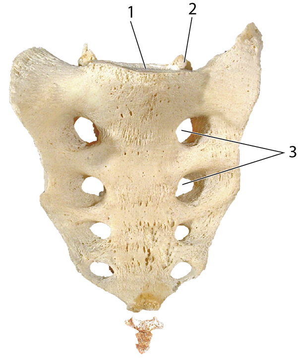<p>What is the name of structure 3?</p>
