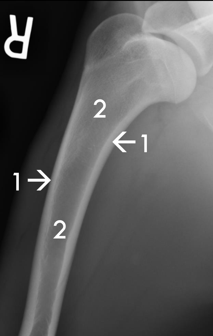 <p>What is 2?</p>